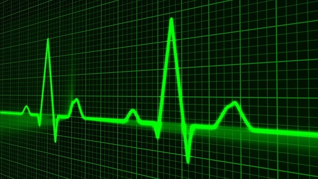 PRINCIPALES EMERGENCIAS CARDIOVASCULARES (CFC) Flo Formación